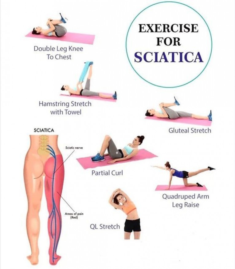 Sciatica Merivale Osteopathy Christchurch